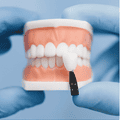 Протезирование зубов